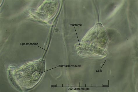  Vorticella! Descubra Este Animal Microscópico Que Faz Uma Dança Giratória Fascinante