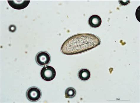 Isospora - Um Parasita Microscópico Que Se Esconde em Intestinos de Mamíferos e Aves!